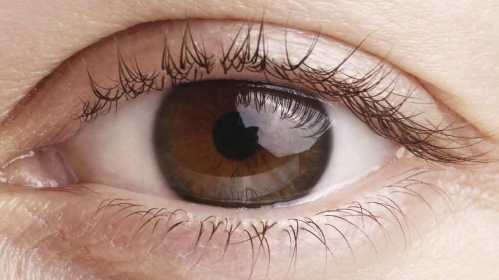 Qué hacer ante la Degeneración Macular