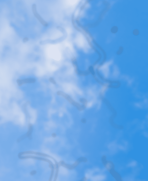 Aparición de manchas flotantes y cambios en su tamaño